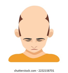Calvicie grave, alopecia en la ilustración vectorial masculina. En la parte superior de la cabeza masculina con mancha calva en el cuero cabelludo aislado sobre fondo blanco. Concepto de salud, pérdida de cabello o tratamiento