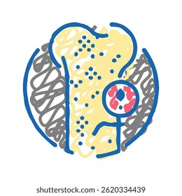 osteoporose grave ícone doodle ícone esboço vetor. sinal ósseo osteoporose grave. ilustração símbolo isolado