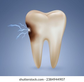 Severe tooth decay at the root causes nerve pain. Concept of dental health care and dental clinic. Realistic vector illustration file.
