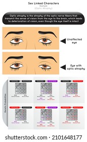 Sex Linked Characters Infographic Diagram Example Optic Atrophy Nerve Fiber Sense Of Vision Eye To Brain Visual Deterioration Punnett Square Genetic Probability Heredity Gene Science Education Vector