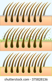 Shampoo which helps to remove dandruff, vector