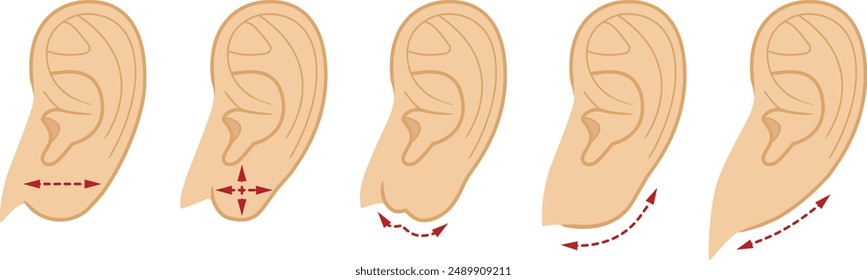 Forma de un lóbulo de la oreja humano. Vector de ilustración aislado sobre fondo blanco