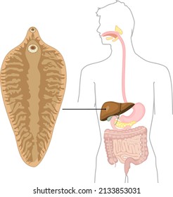 Sheep liver fluke (Fasciola hepatica) and structure of human digestive system. Location of helminth in human body