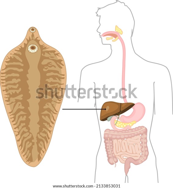 Sheep liver\
fluke (Fasciola hepatica) and structure of human digestive system.\
Location of helminth in human\
body