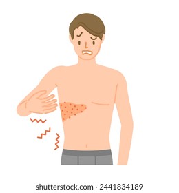 Shingles: Men who experience pain, itching, and swelling from the chest to the back