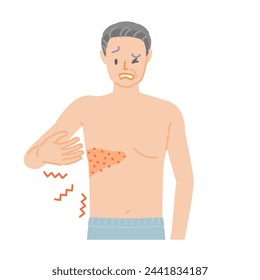 Shingles: Senior man with pain, itching, and swelling from chest to back