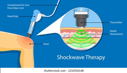 Shockwave therapy SWT physiotherapist treat muscular disorder back neck physical tennis Elbow muscle stimulator ultrasound calcific tendonitis