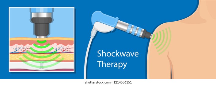 14,639 Shock waves Images, Stock Photos & Vectors | Shutterstock