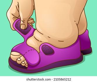 Shoes wearing. How to wear the shoes. Dress up. Edema and shoes wearing problem. Medical illustration. Vector illustration. 