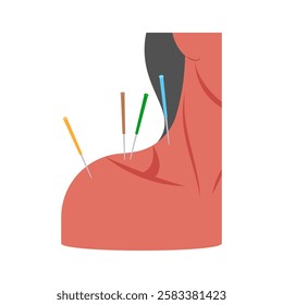 Shoulder Acupuncture flat vector illustration isolated