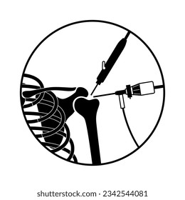 Shoulder arthroscopy procedure. Rotator cuff tears or shoulder joint replacement. Minimally invasive surgery. Ligaments treatment, tendonitis pain or arthritis inflammation medical vector illustration