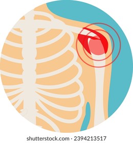 El hueso de hombro tiene una señal roja. Enfermedad de los hombros, lesión en los hombros. Ilustración sobre el diagnóstico de lesiones corporales. Inflamación de la artritis reumatoide. Problemas de salud. Estilo plano