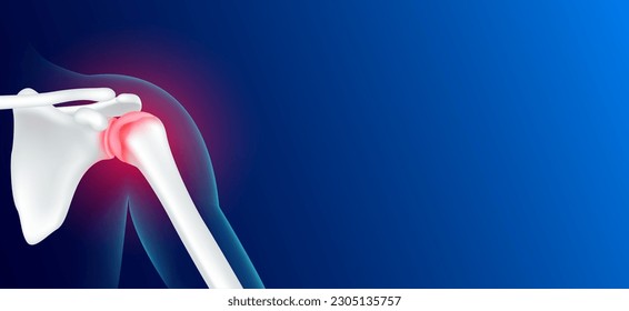 Shoulder bone pain and joint arthritis cartilage becomes worn this results in inflammation swelling. Human skeleton anatomy with copy space for text. Medical x ray film concept. Realistic 3D vector.