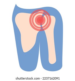 Schulterschmerzen Symbol-Cartoon-Vektorgrafik. Arthritis-Gelenk. Patient