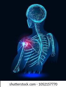 Shoulder painful. Skeleton, 3D Illustration medical concept. Polygonal vector.