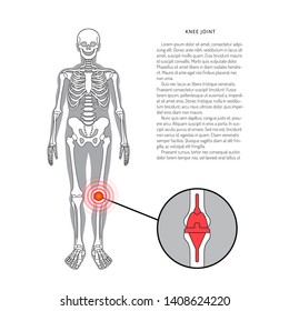 Shoulder prosthesis Joint pain replacement, vector banner with place for text. Arthritis joint pain syndrome and prosthetics, replacement of human joints. Joint pain. Flat vector illustration