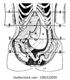 Showing Position Viscera Condition Visceroptosis Vintage Stock Vector ...