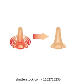 Sick allergy nose vector illustration sign and healthy nose sign.