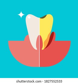 Sick and healthy tooth flat cartoon illustration. Dental  banner. Enamel, gum health and caries protection design.