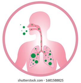 Sick Human Lungs Pneumonia Covid19 Respiratory Stock Vector (Royalty ...