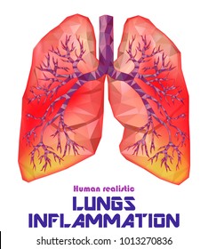 Sick human realistic lungs and trachea in low poly. Pleurisy, an inflammation around the lungs. Infection, tuberculosis, cancer, pulmonary embolism. Vector.