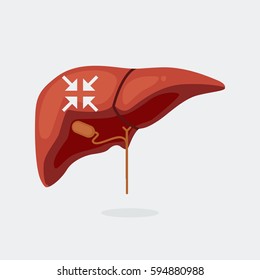 Sick liver vector illustration