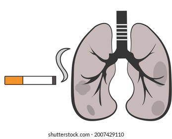 Pulmones enfermos por fumar demasiado
