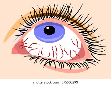 Sick Eyes Images, Stock Photos & Vectors | Shutterstock