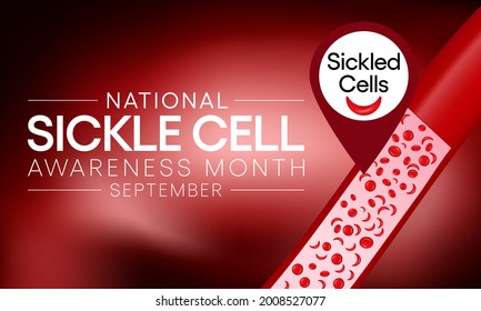 1,383 Sickle cell disease Images, Stock Photos & Vectors | Shutterstock