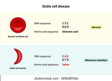 Sickle cell disease, Comparison of DNA sequence between Normal red blood cell and Sickle cell anemia, Scientific study