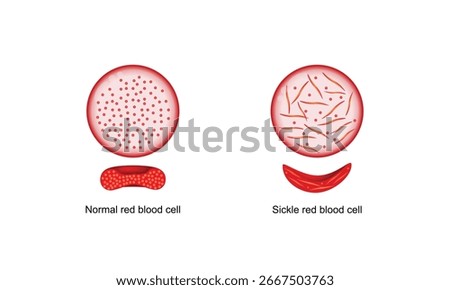 Sickle cell disease. Normal blood cell and Sickle cell. Normal and abnormal hemoglobin. Vector illustration.