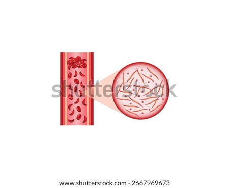 Sickle cell disease. Normal blood cell and Sickle cell. Normal and abnormal hemoglobin. Vector illustration.