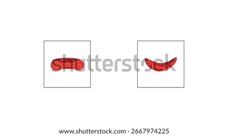Sickle cell disease. Normal blood cell and Sickle cell. Normal and abnormal hemoglobin. Vector illustration.