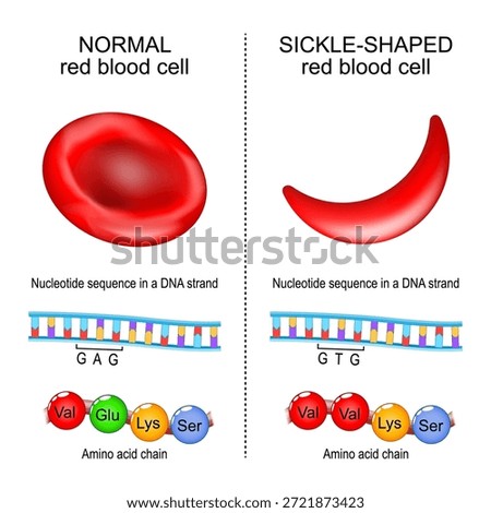 Sickle cell disease. Normal Red blood cell and Sickle-shaped RBCs. Close-up of Amino acid chain and Nucleotide sequence in a DNA strand. Vector illustration