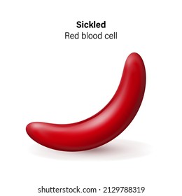 Sickle Cell Disease. Sickled Red Blood Cells Vector.  