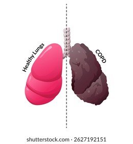 Side by side comparison of healthy lungs versus COPD lungs for medical awareness and educational use