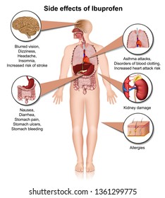 Side effects of ibuprofen 3d medical vector illustration on white background