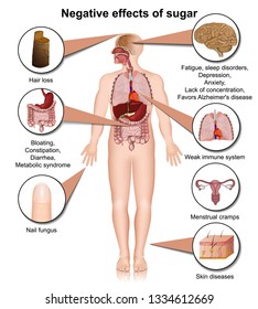 Side effects of sugar on the human body 3d medical vector illustration