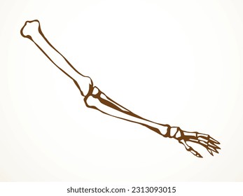 Side view old woman sick torso spine part injury carpal wrist ache hospital surgery care therap scan x ray white logo. Black drawn femal injur thumb medic xray ill elbow ulna pain exam line sketch art