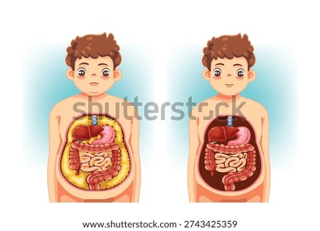 Side-by-side illustration comparing excess visceral fat and a healthy abdominal organ condition.