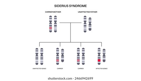 Siderius syndrome poster. X linked intellectual disability. Delayed development of motor skills. Child inherits one copy of a mutated gene from each parent. Affected, carriers or healthy chromosomes