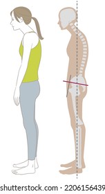 Sideways Woman And Skeleton Standing In A Stooped Posture