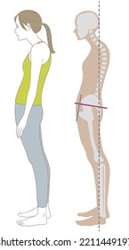 Sideways woman and skeleton standing in stooped, sway-back posture