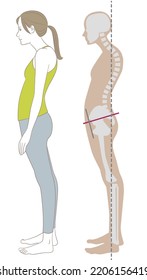 Una mujer de lado de pie con la cintura curvada y la postura encorvada y su esqueleto