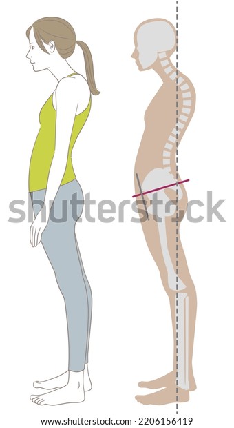 A sideways woman standing with a curved\
waist and stooped posture and her\
skeleton