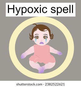 The sign of hypoxia spell or TOF spell there are the sign of central and peripheral cyanosis for medical and education information 