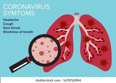 Sign Infographic with Cartoon has Cough, Fever, Sore Throat and Cold in Coronavirus or Covid-19 Outbreak. 