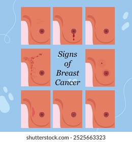 signs of breast cancer infographic awareness flat illustration