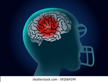 Silhouette Brain of American football player have a red signal. Illustration about injury of athlete