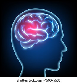 Silhouette of a human head. Migraine disease. Brain nervous system. Stock vector illustration.